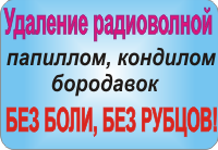 Удаление радиоволной без боли и рубцов папиллом, бородавок